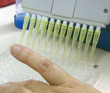 Coronavirus, il diabete non aumenta le possibilità di contrarre l’infezione Coronavirus, il diabete non aumenta le possibilità di contrarre l’infezione