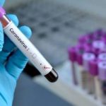 Covid-19, gli esperti all’Iss “Geloni ai piedi possibile sintomo inedito nei bambini”