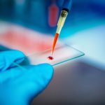 Riscontrati problemi di continuità terapeutica nel trattamento dei pazienti con malattie rare