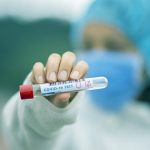 Covid, 34 casi a Santo Stefano Quisquina, quasi tutti ragazzi