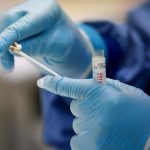 “Test sierologici, includere categorie più a rischio”