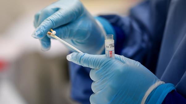 “Test sierologici, includere categorie più a rischio”