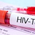 Hiv, con l’emergenza sanitaria crescono i problemi per i pazienti