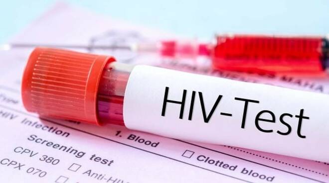 Hiv, con l’emergenza sanitaria crescono i problemi per i pazienti