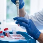 Coronavirus, gli uomini rischiano di più? La causa potrebbe essere il testosterone