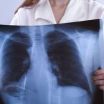 Malattie respiratorie, un over 60 su sette ne soffre e non lo sa