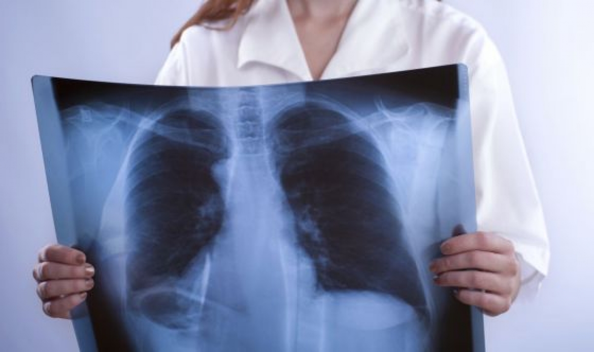 Malattie respiratorie, un over 60 su sette ne soffre e non lo sa