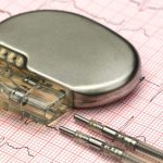 A Palermo un ambulatorio per il controllo dei pacemaker cardiaci