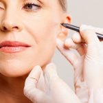 Medicina estetica, nel post quarantena  è corsa dal chirurgo per il restyling