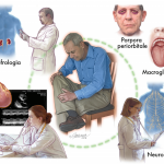 Amiloidosi, malattia rara che  in Sicilia colpisce più che nel resto d’Italia