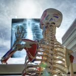 Disturbi muscolo-scheletrici, Catania al centro del progetto Prevent4Work