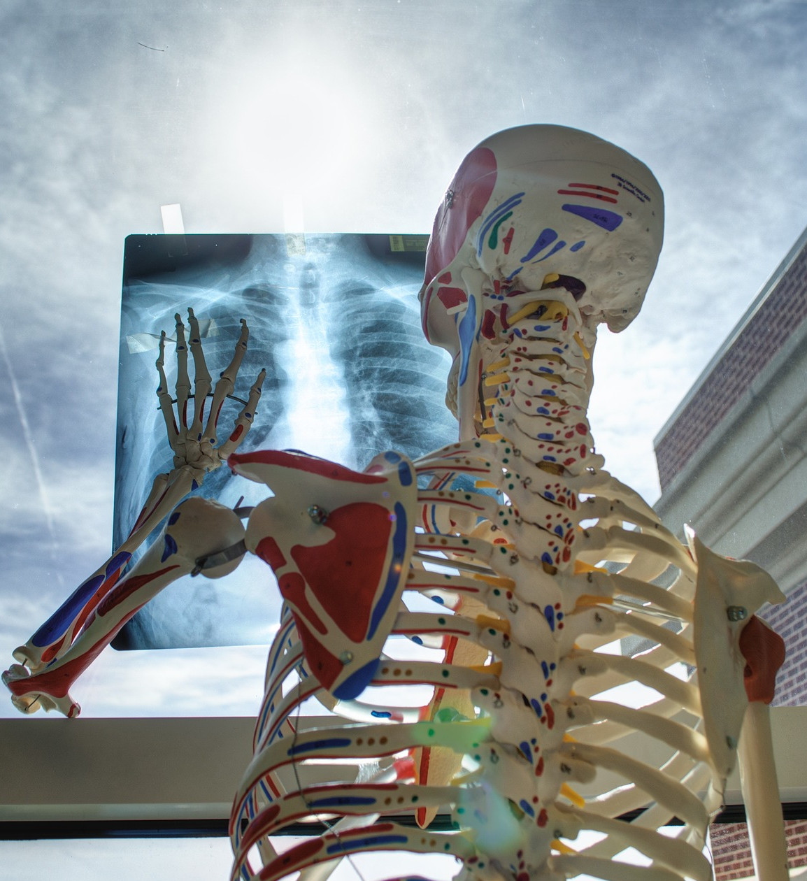 Disturbi muscolo-scheletrici, Catania al centro del progetto Prevent4Work