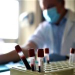 Tutti i numeri della Sanità siciliana ai tempi del Covid