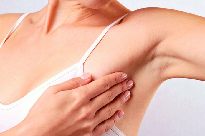 Tumore al seno, il test per evitare chemioterapie superflue