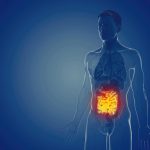 Malattie infiammatorie intestino, software donato alla rete siciliana