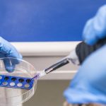 Malattie rare, sette progetti di ricerca finanziati grazie agli sforzi di Telethon