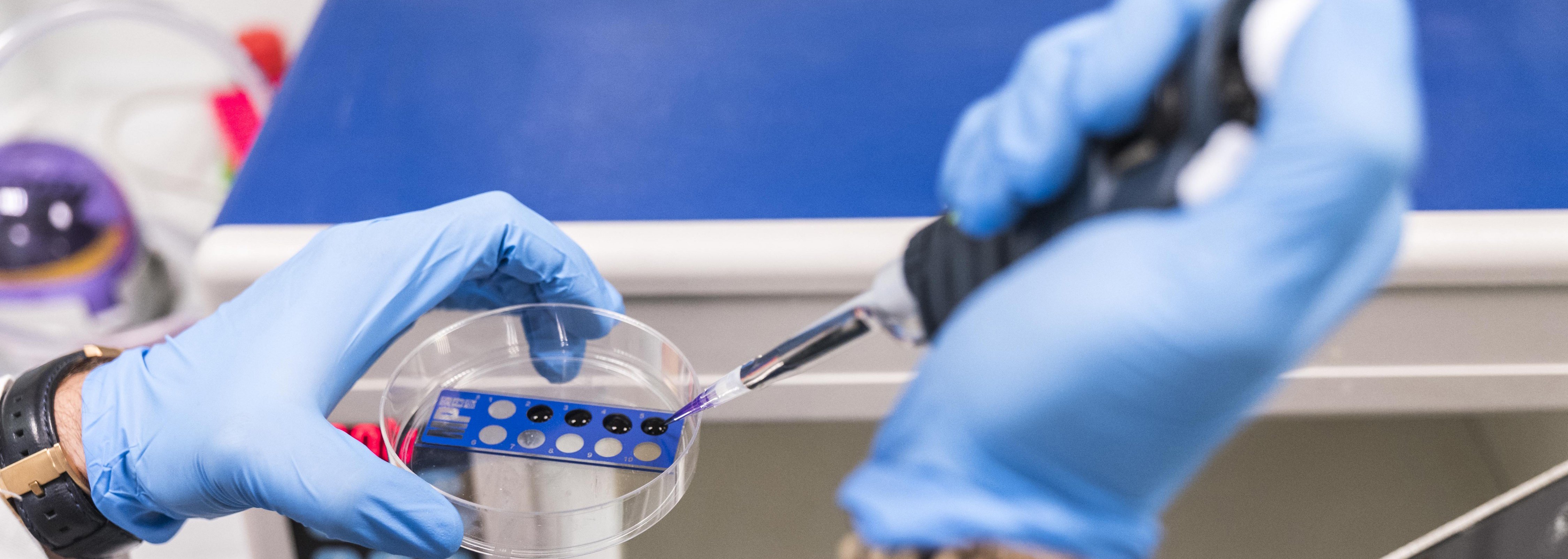 Malattie rare, sette progetti di ricerca finanziati grazie agli sforzi di Telethon