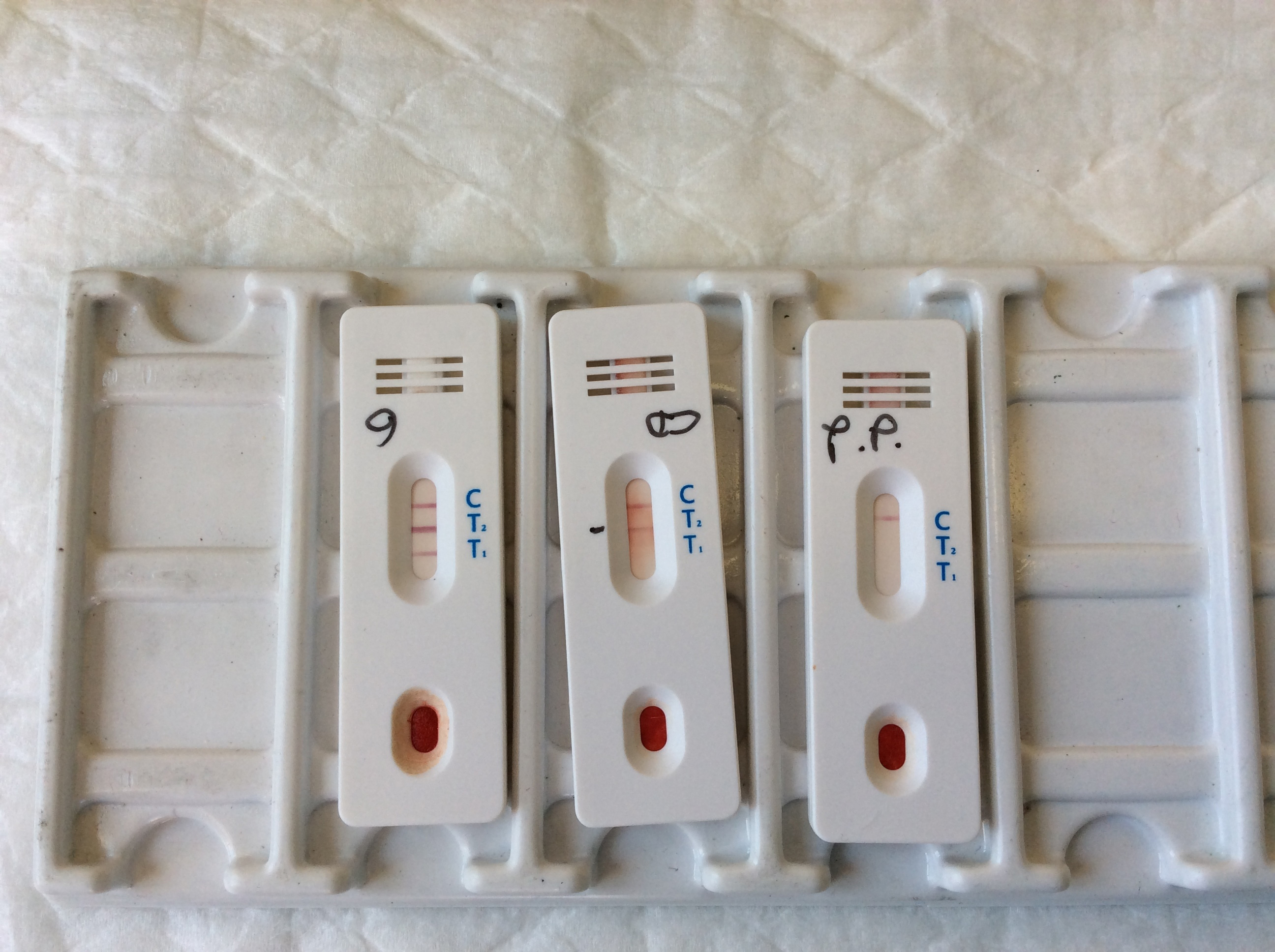 Test sierologici su personale scolastico, screening Asp Enna