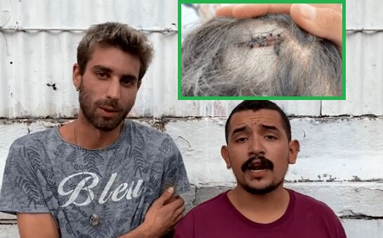 Omofobia, aggrediti a Padova per un bacio gay