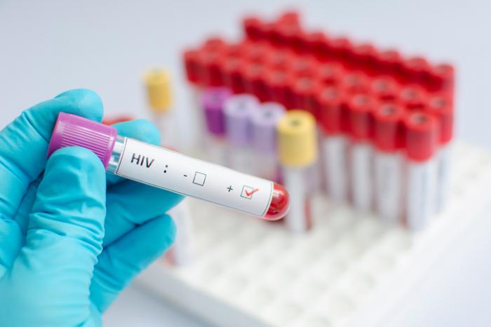 Oggi la Giornata mondiale contro l’Aids, nel 2019 calano le nuove diagnosi da Hiv ma cresce il contagio tra i giovani