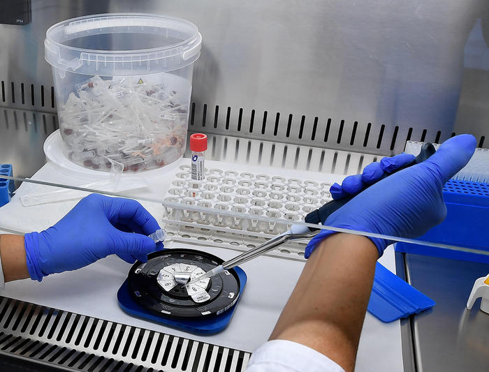 Covid, ecco come predire sintomi gravi, i nuovi test su sangue e saliva