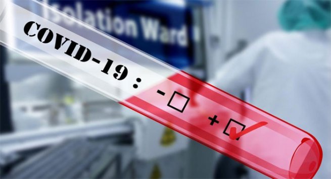 Covid alle Isole Eolie, isolani e turisti in fila per il tampone