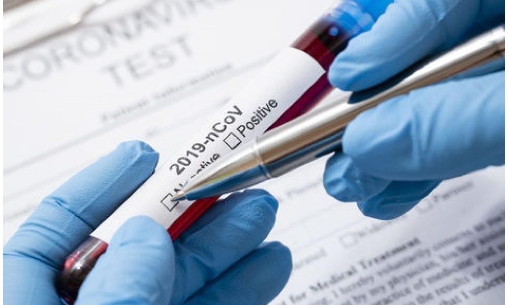 Covid, in Sicilia 757 nuovi positivi e 6 morti nella giornata di ieri