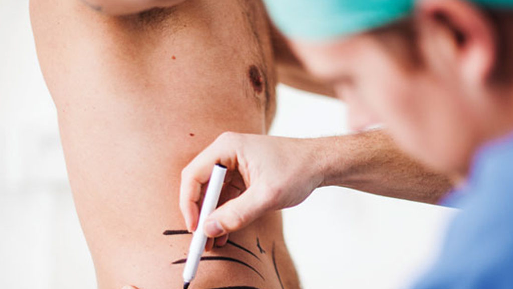 “Togliere l’Iva sulla chirurgia estetica”: la proposta del centrodestra