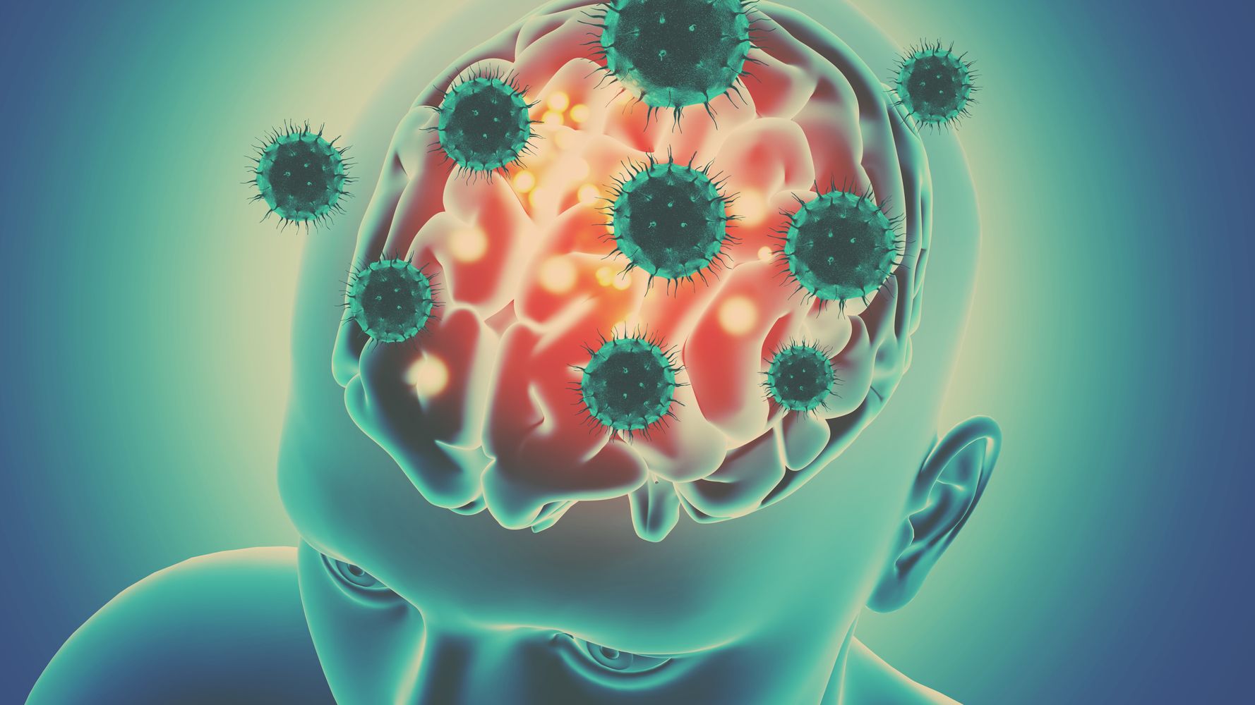 Covid e danni al cervello: “Può invecchiare di 20 anni”. Cosa dice lo studio