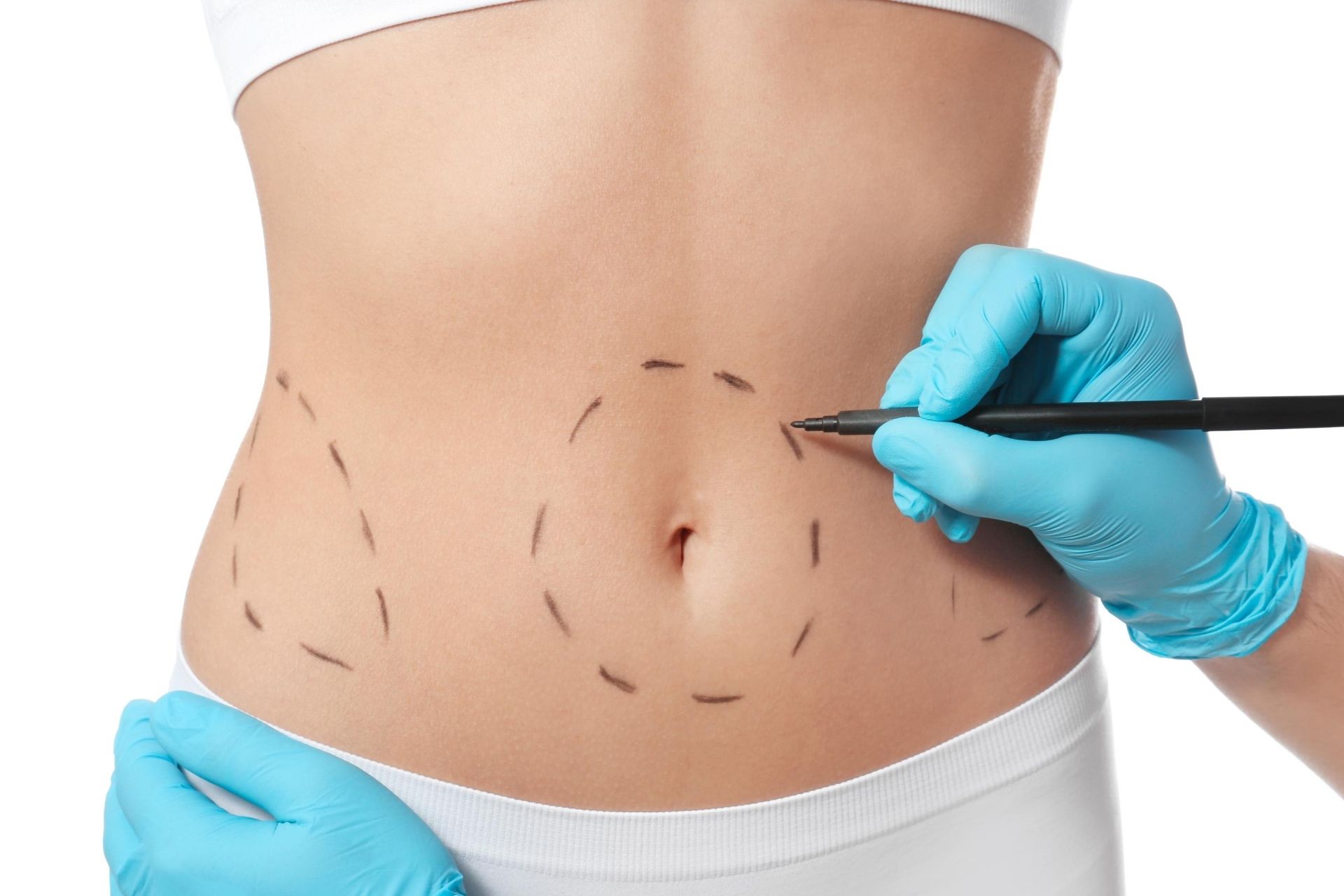 Chirurgia estetica, gli interventi più richiesti: seno, occhi, naso e girovita