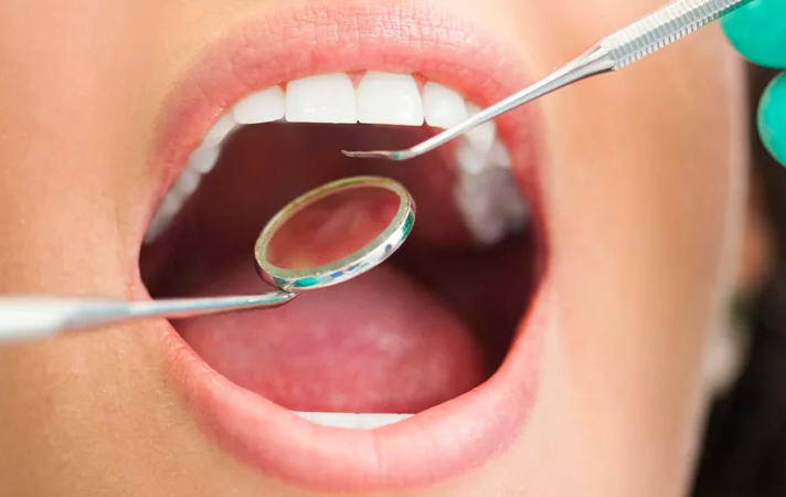 Ingoia ago di 4 cm durante visita dal dentista: operata d’urgenza Ingoia ago di 4 cm durante visita dal dentista: operata d’urgenza