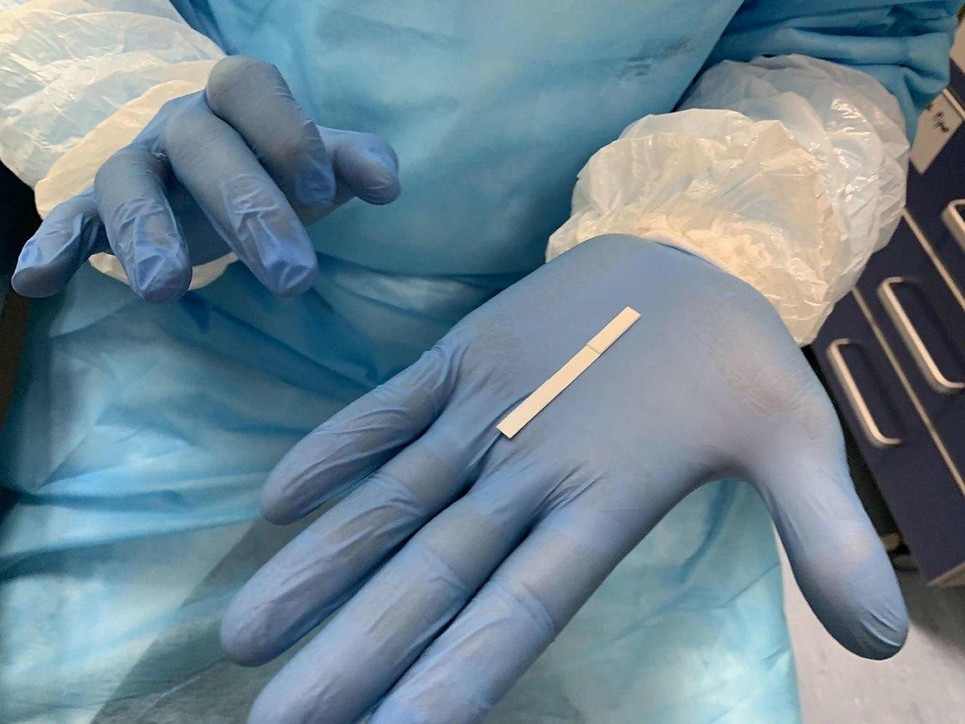 Green pass, test salivari, come funzionano e quanto costano