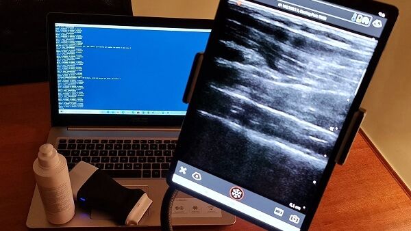 Tumore al seno, Unicredit finanzia progetto della onlus vEyes per la diagnosi precoce Tumore al seno, Unicredit finanzia progetto della onlus vEyes per la diagnosi precoce