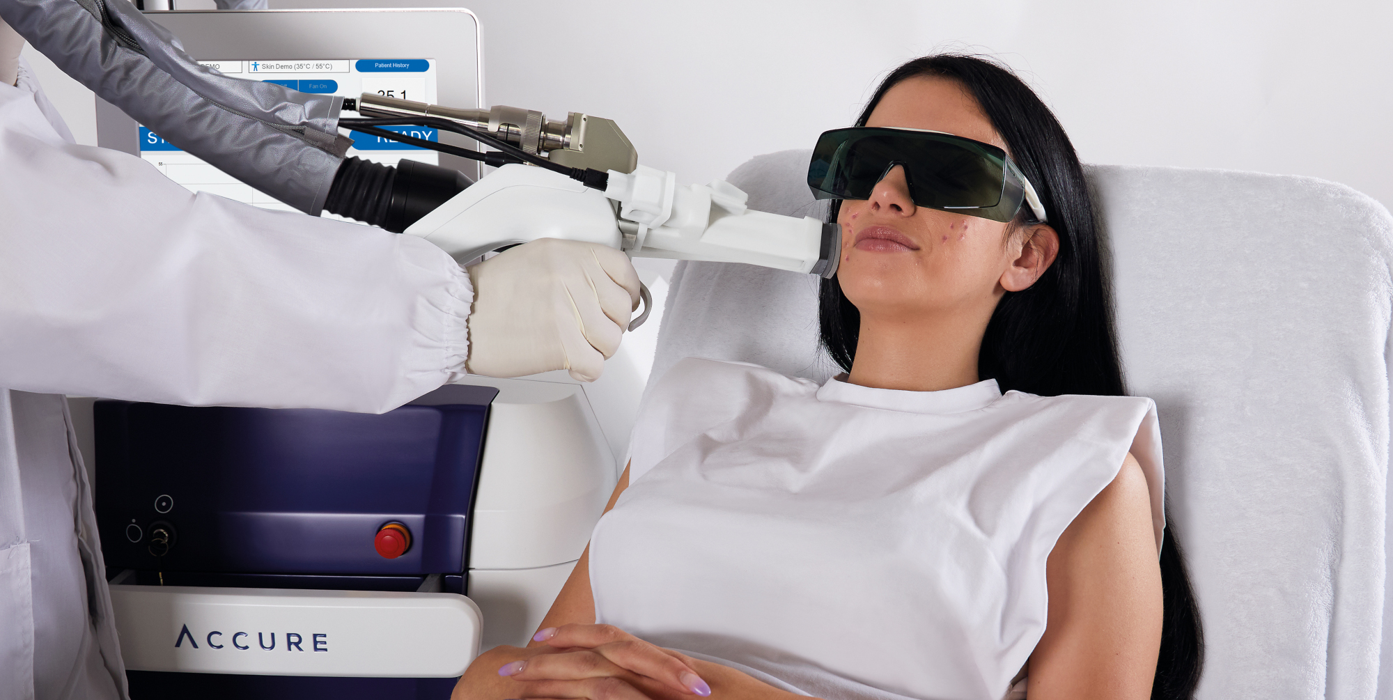 A Palermo arriva il laser che riduce l’acne sino al 90 per cento