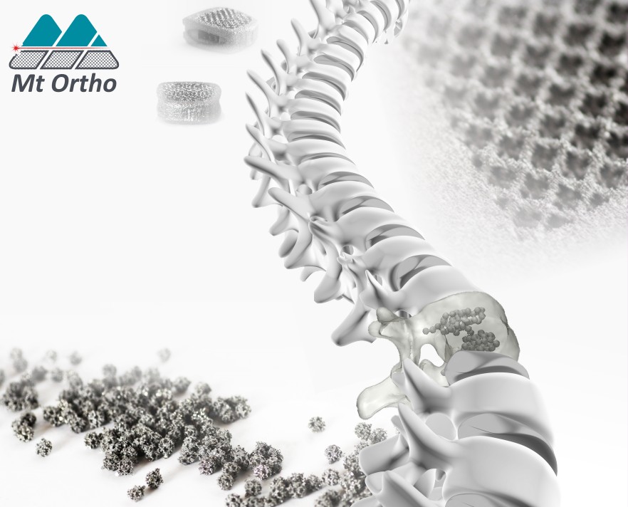 Imprese, Mt Ortho, emesso bond da 3mln per progetto crescita Imprese, Mt Ortho, emesso bond da 3mln per progetto crescita