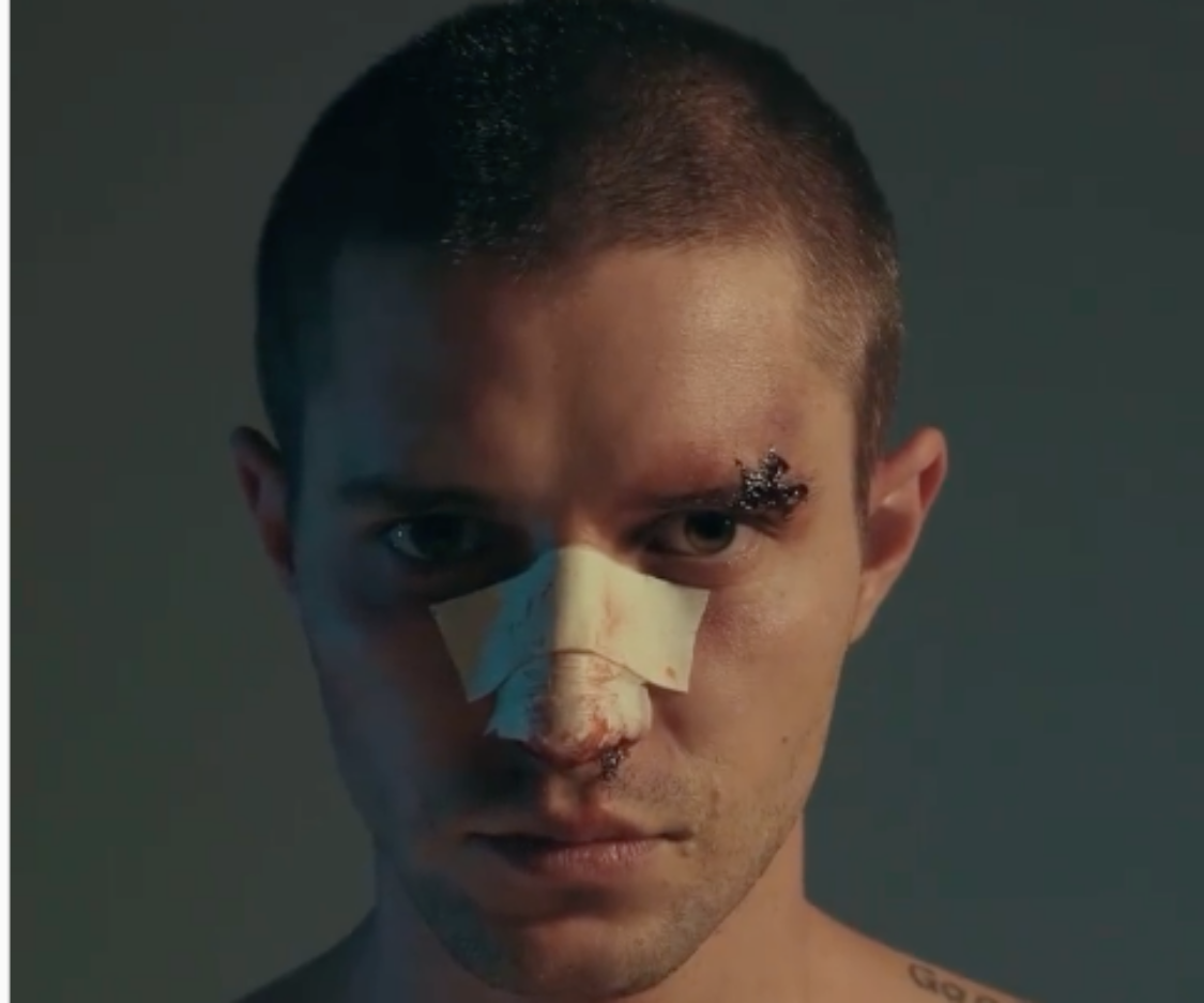 “Ansia”, l’amore velenoso nel nuovo singolo di Alberto