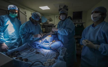 Epidemia fungo nero, “effetto collaterale del Covid”, già oltre 4mila morti