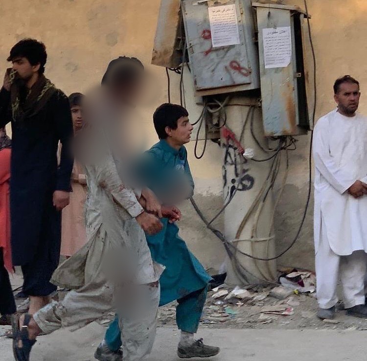 Afghanistan, attentato terroristico, almeno 90 morti, anche bambini