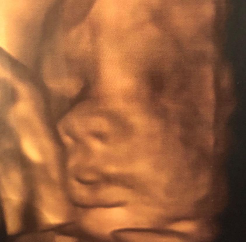 Covid, pubblica la foto dell’ecografia e lancia un appello ai No Vax