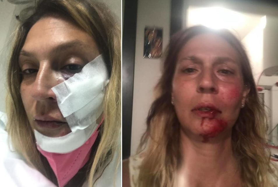 Pestata mentre curava cani randagi, una famiglia finisce ai domiciliari Pestata mentre curava cani randagi, una famiglia finisce ai domiciliari