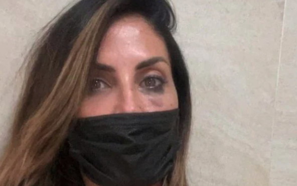 Guendalina Tavassi picchiata, l’occhio nero e la foto, il colpevole