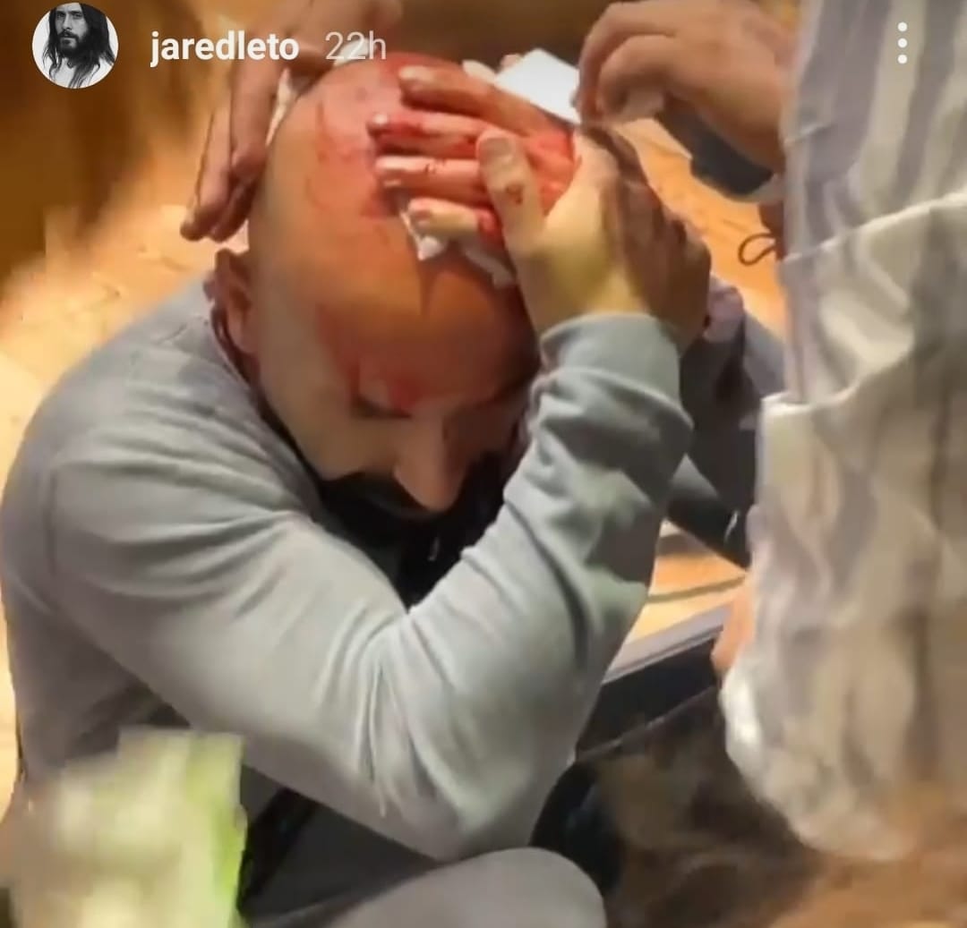 Jared Leto negli scontri a Roma, i video su Instagram e i lacrimogeni