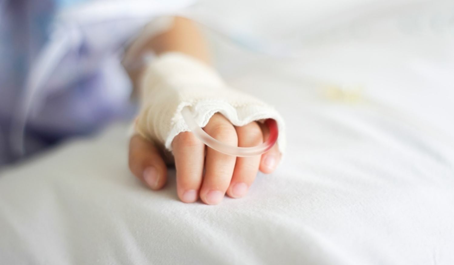 Catenanuova, guarito il bimbo ustionato grazie al trapianto di pelle di un genitore