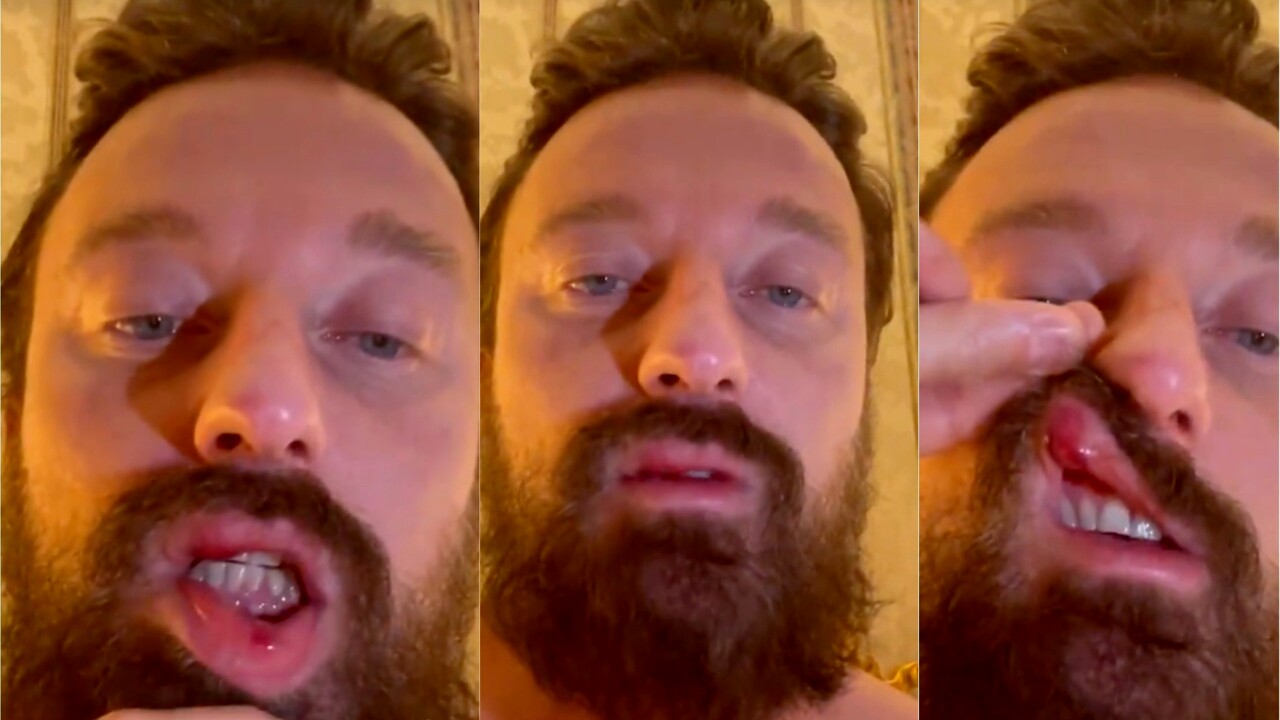 Dj Francesco preso a pugni da McGregor, foto e video sui social