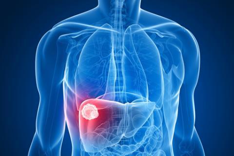 Farmaci innovativi e test contro l’Epatite C, malattia sommersa nel 70% dei casi