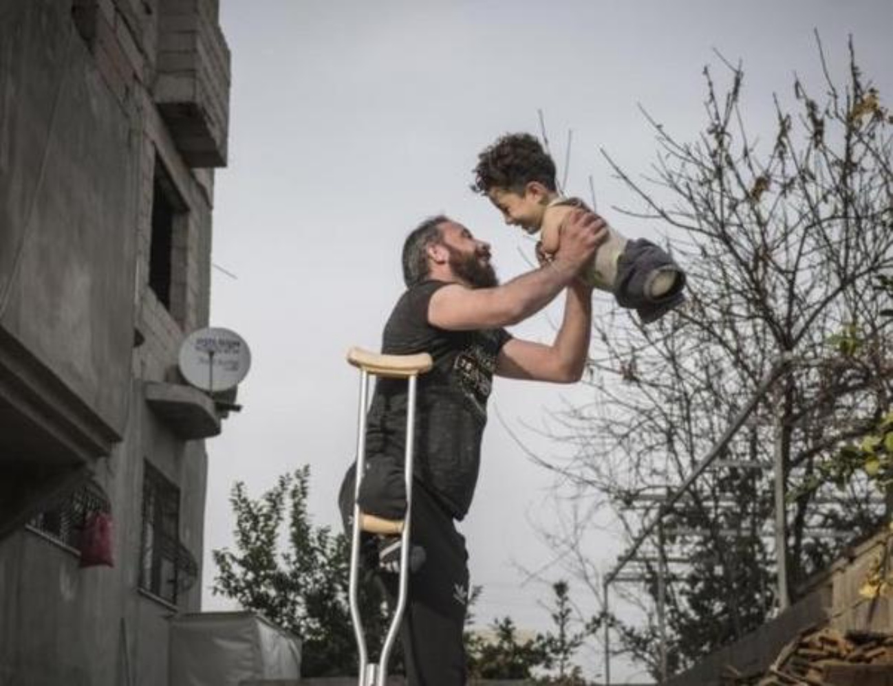 Bimbo e papà senza arti, in una foto il dramma della Siria