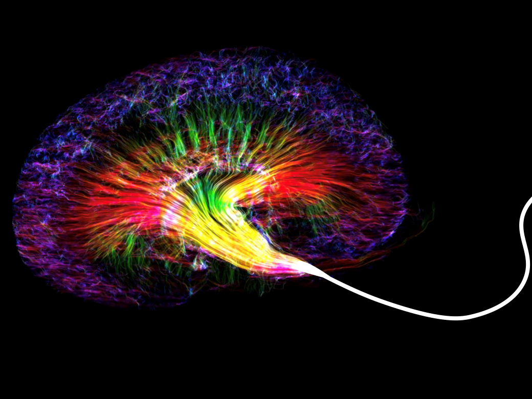 Psicogeriatria, nel Catanese il medico “scultore” delle diagnosi