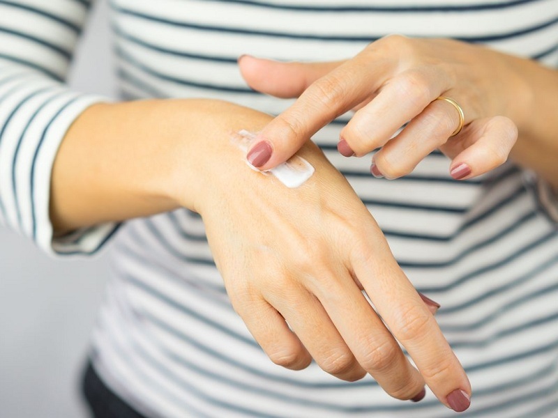 Ustioni della pelle e piccole scottature: cinque rimedi per gli incidenti domestici