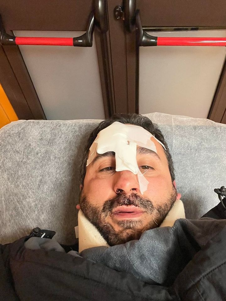 Incidente stradale per lo chef Natale Giunta, “Colpa di una buca”