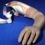 Chi è l’uomo col braccio di silicone per evitare il vaccino